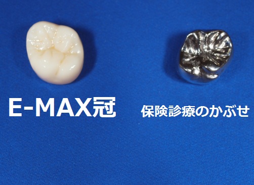 名古屋市天白区でマウスピース矯正とインプラントに力を入れる天白うめがおか歯科・矯正歯科のE-MAX