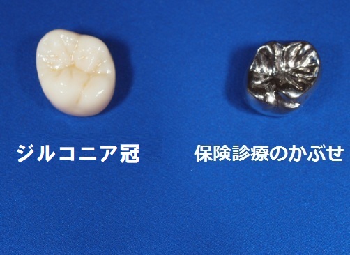 名古屋市天白区でマウスピース矯正とインプラントに力を入れる天白うめがおか歯科・矯正歯科のE-MAX